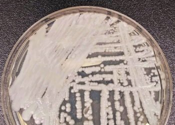 Hospital do Servidor Público de SP tem surto de superfungo – 28/03/2025 – Equilíbrio e Saúde