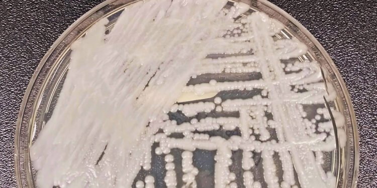 Hospital do Servidor Público de SP tem surto de superfungo – 28/03/2025 – Equilíbrio e Saúde