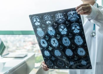 Tratamento prevê melhora de 70% nos tremores de Parkinson – 28/03/2025 – Equilíbrio e Saúde