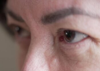 Remédio para distúrbio do movimento causaram vício em sexo – 14/03/2025 – Equilíbrio e Saúde