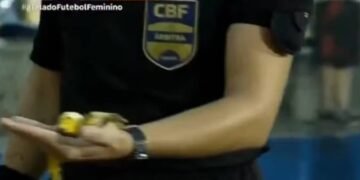 CBF pede punição após banana contra jogadoras do Sport – 01/04/2025 – Esporte
