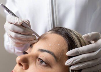 Preenchedores estéticos travam batalha comercial na Anvisa – 01/04/2025 – Painel S.A.